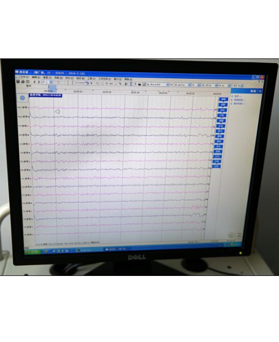腦電圖美國尼高力